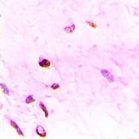 Polyclonal Rabbit anti-Human MT2A / Metallothionein 2A Antibody (IHC, WB)