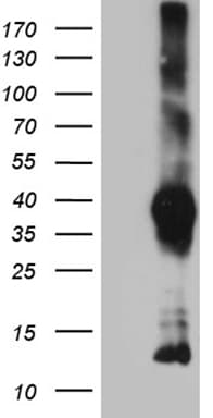 Monoclonal Mouse anti-Human ITM2A Antibody (clone OTI8C3, WB)