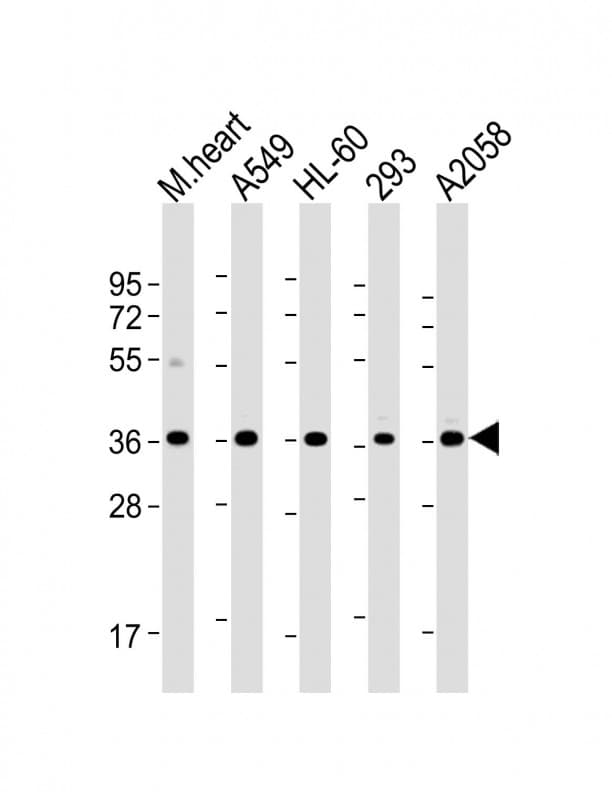 WBP2 Antibody (C-Terminus, clone 932CT1.3.7)
