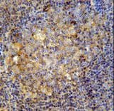 MME / CD10 Antibody (aa721-747)