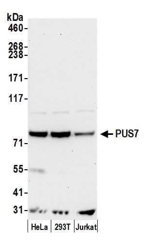 PUS7 Antibody (aa100-150)