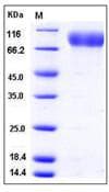 Human GPNMB / Osteoactivin Protein (Recombinant His,C-terminus)