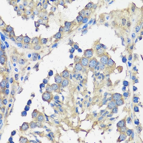 Polyclonal Rabbit anti-Human ASZ1 / Orf3 Antibody (IHC, IF)