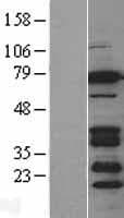 BRSK2 Protein (Over-Expression Lysate Myc-DDK (Flag))