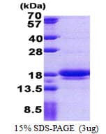 Human LIMD2 Protein (Recombinant His)