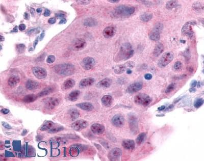 PathPlus™ ESRRA / ERR Alpha Antibody (Internal)