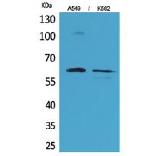 SMAD1 Antibody (150-230 aa)
