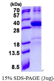 Human HES7 Protein (Recombinant His)