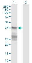 Monoclonal Mouse anti-Human CNN3 Antibody (clone 4C4, WB)