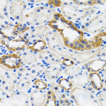 Polyclonal Rabbit anti-Human CHUK / IKKA / IKK Alpha Antibody (IHC, IF, WB)