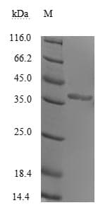 Human Rhinovirus A VP1 Protein (Recombinant 10His, N-terminus)