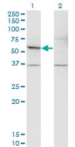 Monoclonal Mouse anti-Human DFNA5 Antibody (clone 1E10, WB)