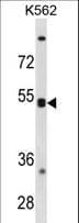 Polyclonal Rabbit anti-Human CXCR5 Antibody (aa1-30, WB)