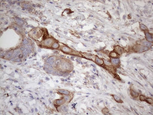 PDIA6 / ERP5 Antibody (clone OTI8H4)