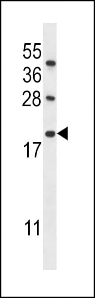 IFI6 / G1P3 Antibody (aa5-34)