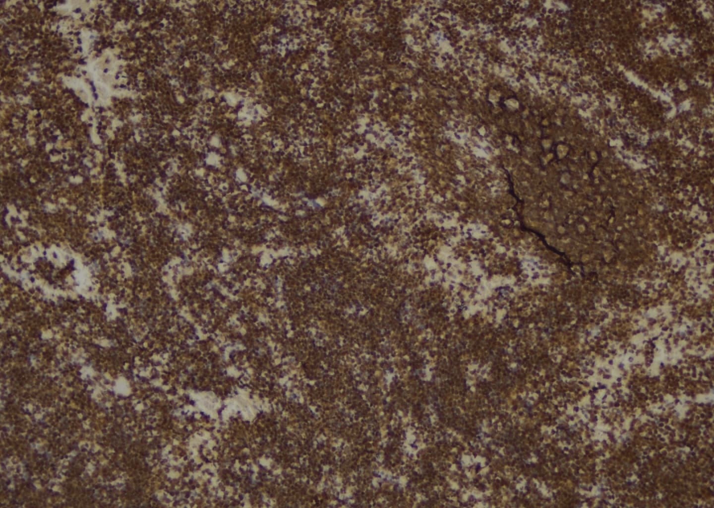 Polyclonal Rabbit anti-Human PLCG1 Antibody (IHC, IF, WB)