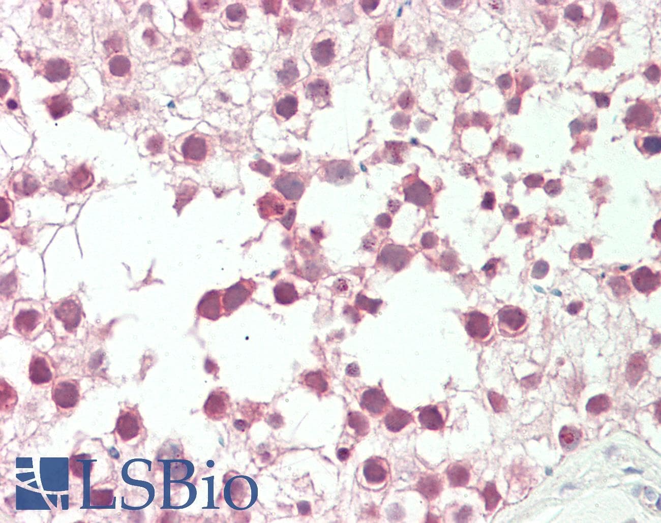 IHC-plus™ RANBP2 / TRP1 Antibody (aa1050-1100)