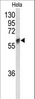 GALNT2 Antibody (aa26-53)