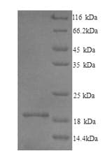 Mouse IL1F10 Protein (Recombinant 6His, N-terminus)