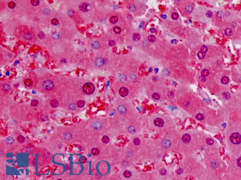 IHC-plus™ LDH / Lactate Dehydrogenase Antibody