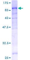 Human SF1 Protein (Recombinant GST)