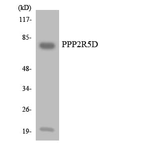 Polyclonal Rabbit anti-Human PPP2R5D Antibody (aa525-574, WB)