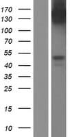Human CCR5 Protein (Over-Expression Lysate Myc-DDK (Flag))