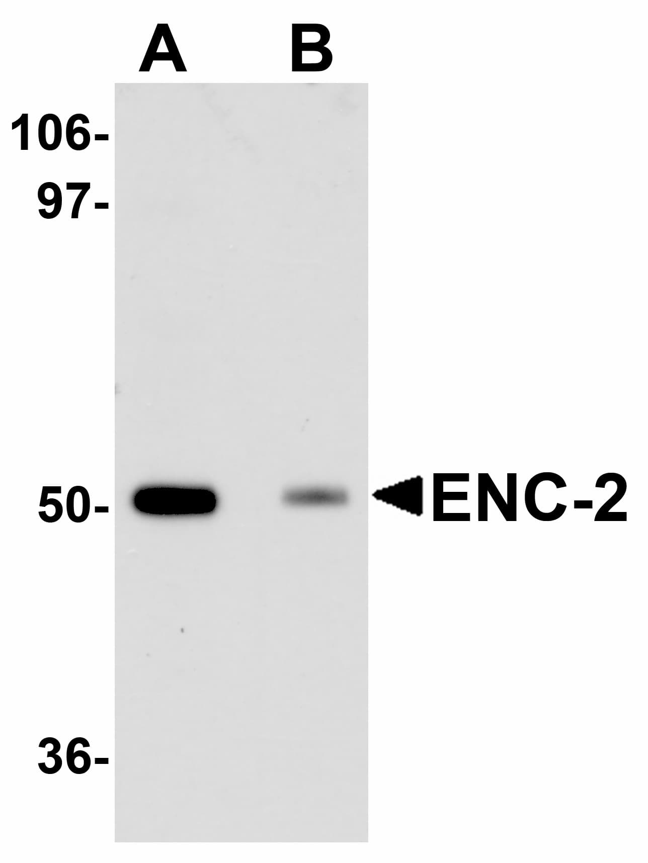 IHC-plus™ Polyclonal Chicken anti-Human KLHL25 Antibody (IHC, IF, WB)