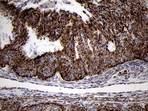 TIMM8A Antibody (clone OTI5C8)