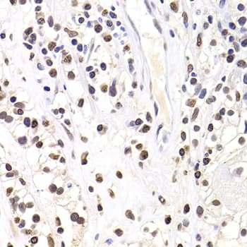 Polyclonal Rabbit anti-Human SOX5 Antibody (aa1-120, IHC, IF, WB)