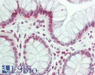 IHC-plus™ Polyclonal Rabbit anti-Human TSHZ1 Antibody (aa851-900, IHC)