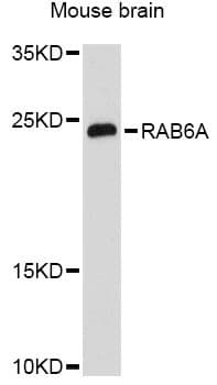 Polyclonal Rabbit anti-Human RAB6A / RAB6 Antibody (WB)