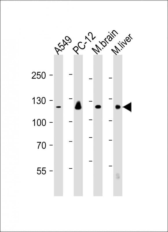 EIF2AK3 / PERK Antibody (clone 1385CT582.4.39)