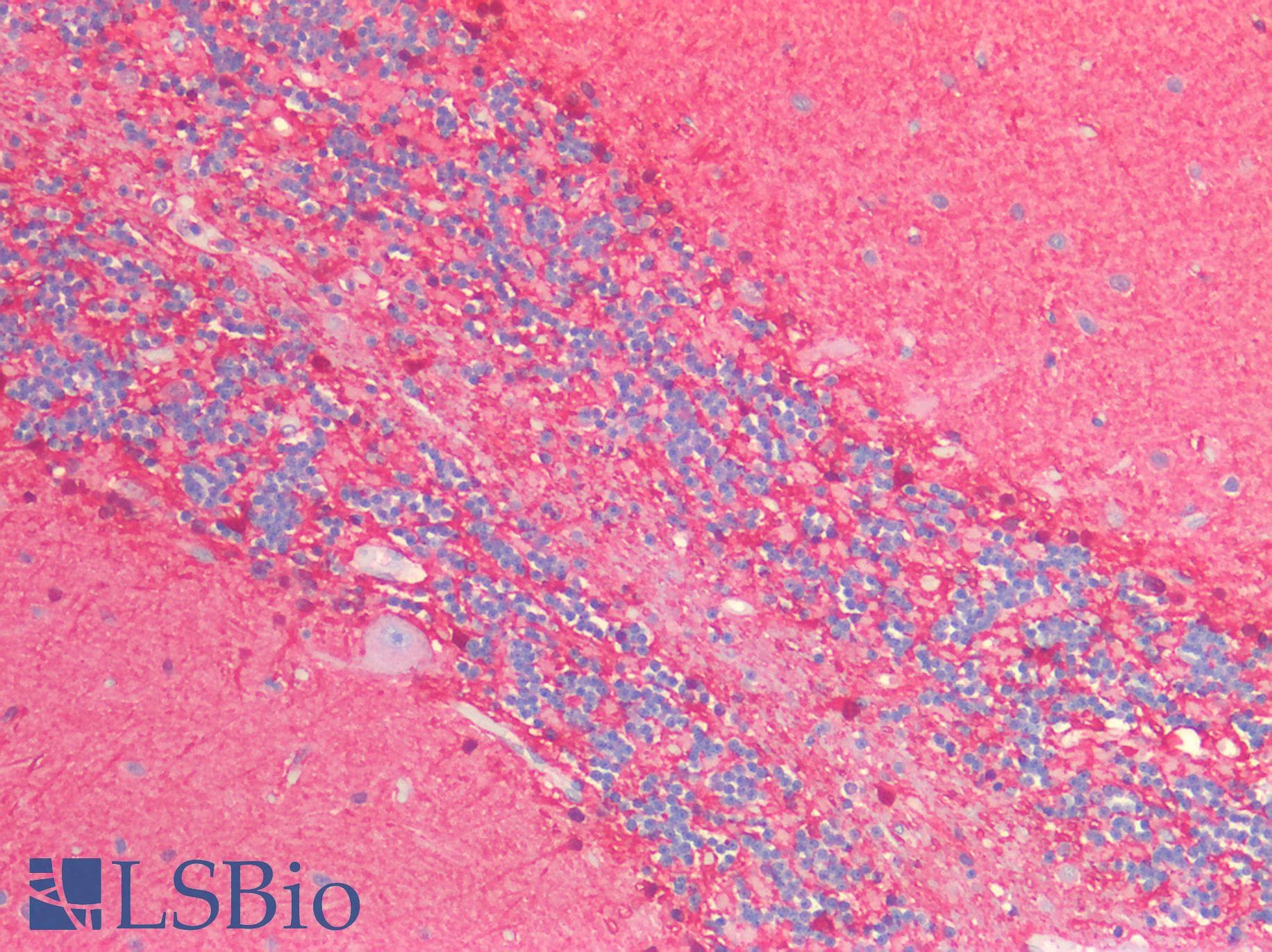 PathPlus™ Polyclonal Rabbit anti-Human ENO1 / Alpha Enolase Antibody (IHC, WB)