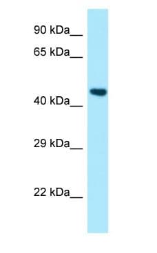 Polyclonal Rabbit anti-Human PSTPIP1 Antibody (aa91-140, WB)