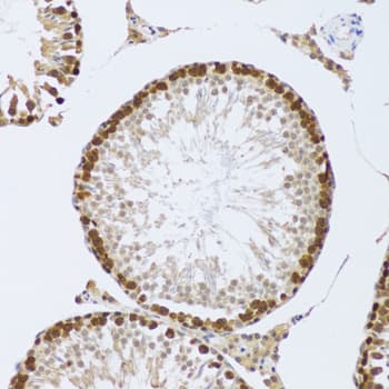 Polyclonal Rabbit anti-Human CIRP / CIRBP Antibody (IHC, IF, WB)