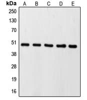 Polyclonal Rabbit anti-Human CASP9 / Caspase 9 Antibody (Internal, IHC, IF, WB)