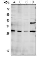 Polyclonal Rabbit anti-Human CDC42EP3 Antibody (WB)