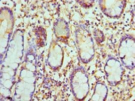Polyclonal Rabbit anti-Human CCL8 / MCP2 Antibody (aa23-99, IHC)