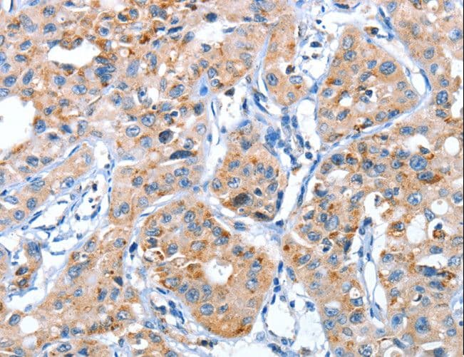 AUP1 Antibody