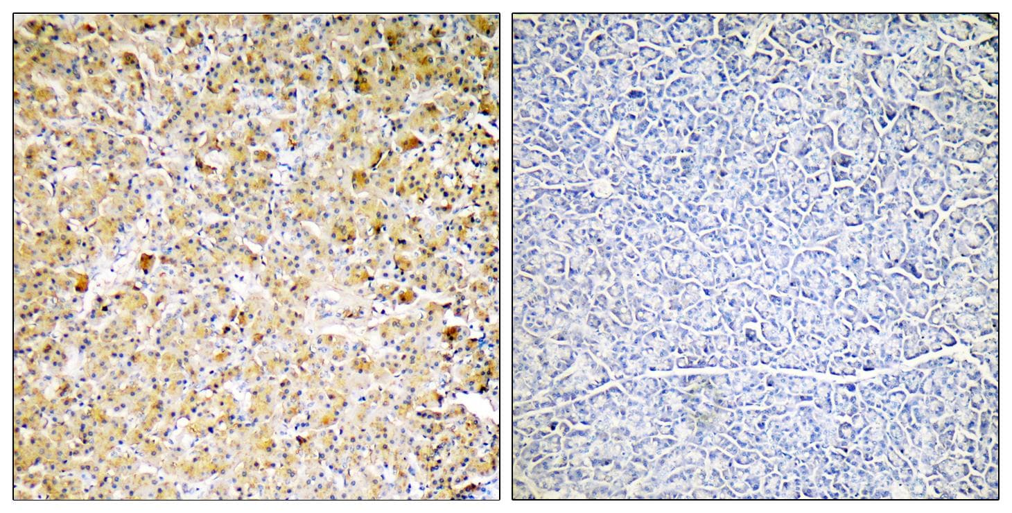 Polyclonal Rabbit anti-Human CPA1 / Carboxypeptidase A Antibody (IHC, WB)
