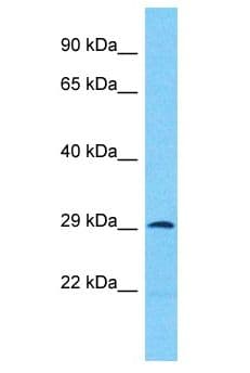 Polyclonal Rabbit anti-Human ANKRD44 Antibody (aa171-220, WB)