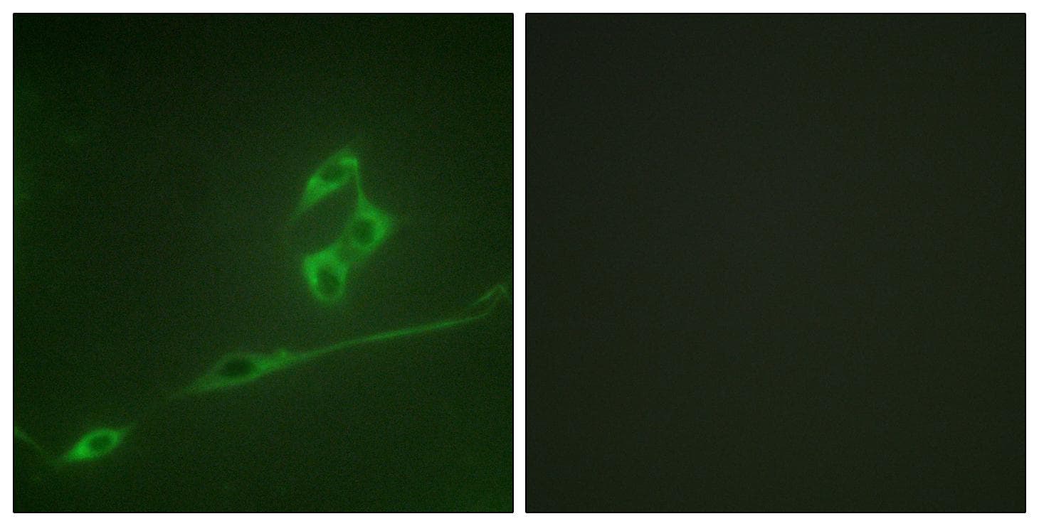 RPS6KB1 / P70S6K / S6K Antibody (p371)