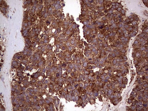 RET Antibody (aa713-1017, clone OTI1G1)