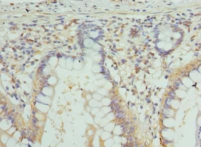 GJA4 / CX37 / Connexin 37 Antibody