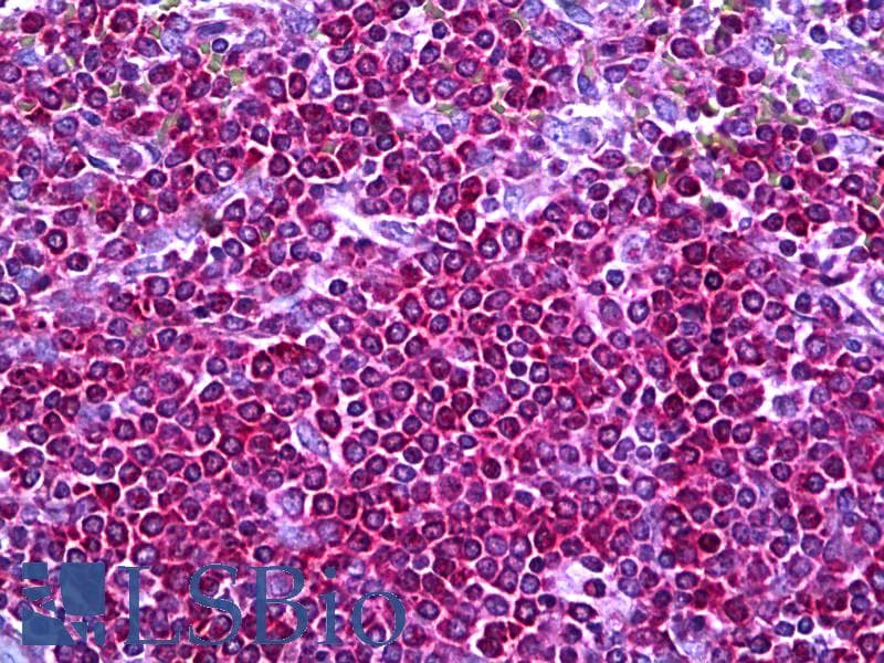 IHC-plus™ Neurofibromin / NF1 Antibody (aa1551-1600)