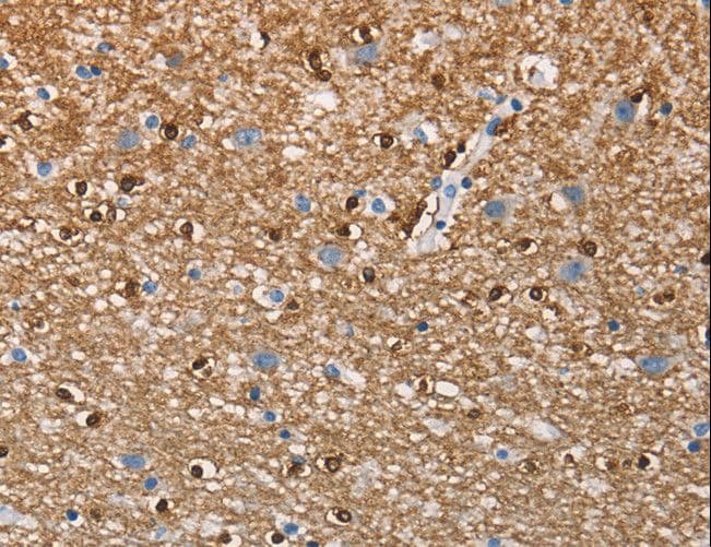 CD66c / CEACAM6 Antibody