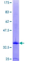 Human CXCL4 / PF4 Protein (Recombinant GST)