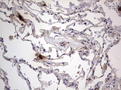 Monoclonal Mouse anti-Human SMPD1 / Acid Sphingomyelinase Antibody (clone OTI3H7, aa62-341, IHC, WB)