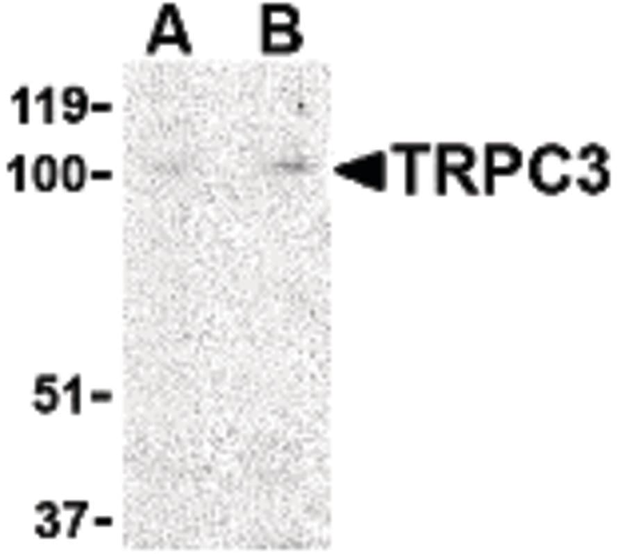 IHC-plus™ Polyclonal Rabbit anti-Human TRPC3 Antibody (IHC, WB)